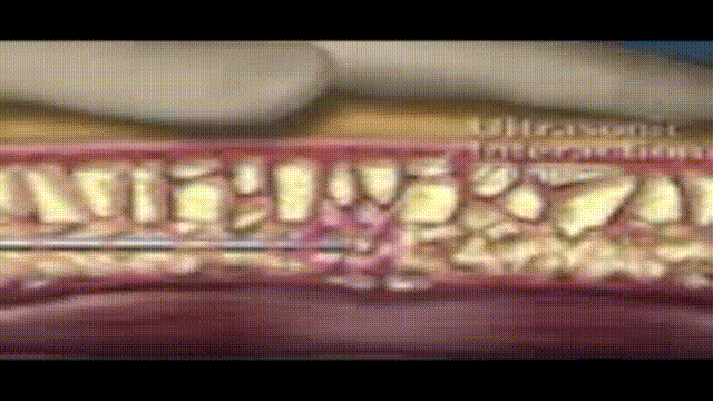 db20b0e46fa1aa51e1afe0166e079518_1721698230_4634.gif